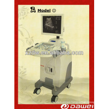 B type Ultrasound Scanner &Full Digital Trolley Ultrasound